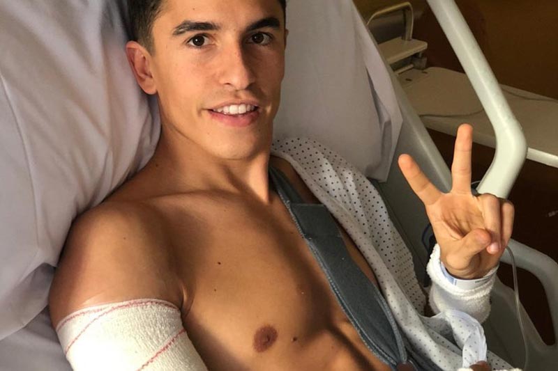 Kondisi Lengan Kanan Marc Marquez Memuaskan